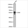 KO-Validated CDK8 Rabbit pAb (20 μl)