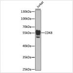 KO-Validated CDK8 Rabbit pAb (20 μl)