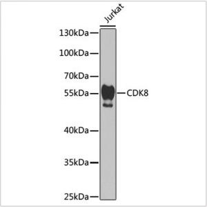 KO-Validated CDK8 Rabbit pAb (20 μl)