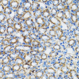 KO-Validated α-Catenin Rabbit pAb (20 μl)