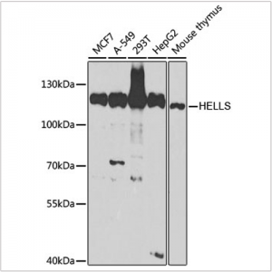 KO-Validated Lsh/HELLS Rabbit pAb (20 μl)