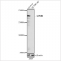 KO-Validated SETDB1 Rabbit pAb (20 μl)