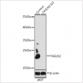KO-Validated TAGLN2 Rabbit pAb (20 μl)