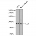 KO-Validated TLK2 Rabbit pAb (20 μl)