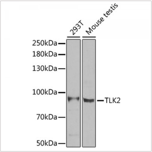 KO-Validated TLK2 Rabbit pAb (20 μl)