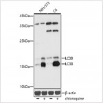 KD-Validated LC3B Rabbit pAb (20 μl)