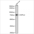 KO-Validated AMPKα2 Rabbit pAb (20 μl)