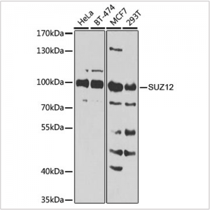 KO-Validated SUZ12 Rabbit pAb (20 μl)