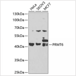 KO-Validated PRMT6 Rabbit pAb (20 μl)