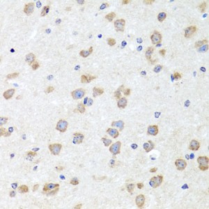 KO-Validated CHD1 Rabbit pAb (20 μl)