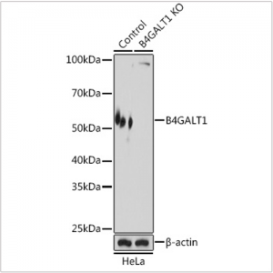 KO-Validated B4GALT1 Rabbit pAb (20 μl)