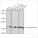 KO-Validated CDKN2C/p18-INK4C Rabbit mAb (20 μl)