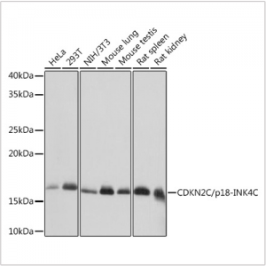 KO-Validated CDKN2C/p18-INK4C Rabbit mAb (20 μl)
