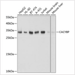 KO-Validated CACYBP Rabbit pAb (20 μl)