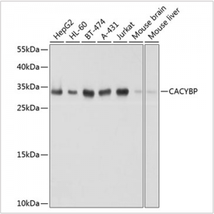 KO-Validated CACYBP Rabbit pAb (20 μl)