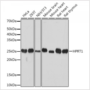 KO-Validated HPRT1 Rabbit mAb (20 μl)