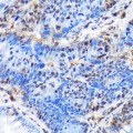 KO-Validated CTIP1/BCL11A Rabbit mAb (20 μl)