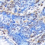 KO-Validated CTIP1/BCL11A Rabbit mAb (20 μl)