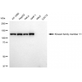 KD-Validated KIF11 Rabbit mAb (20 μl)