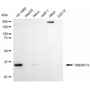 KD-Validated TMEM173 Rabbit mAb (20 μl)