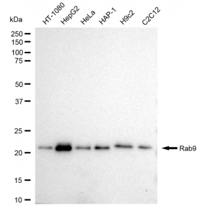 KD-Validated Rab9 Rabbit mAb (20 μl)