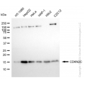 KD-Validated CDKN2C Rabbit mAb (20 μl)