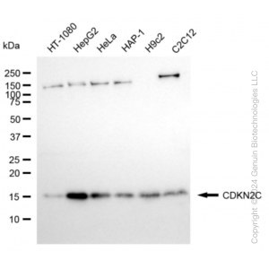 KD-Validated CDKN2C Rabbit mAb (20 μl)