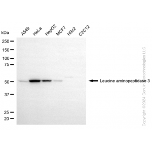 KD-Validated LAP3 Rabbit mAb (20 μl)