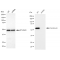 KD-Validated CRT Rabbit mAb (20 μl)