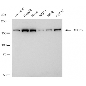 KD-Validated ROCK2 Rabbit mAb (20 μl)
