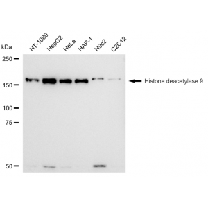 KD-Validated HDAC9 Rabbit mAb (20 μl)