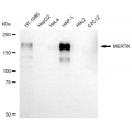 KD-Validated MERTK Rabbit mAb (20 μl)
