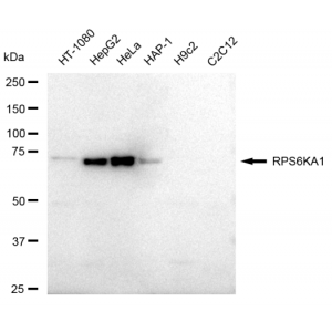 KD-Validated RPS6KA1 Rabbit mAb (20 μl)