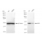 KD-Validated NEK2 Rabbit mAb (20 μl)