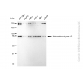 KD-Validated HDAC10 Rabbit mAb (20 μl)