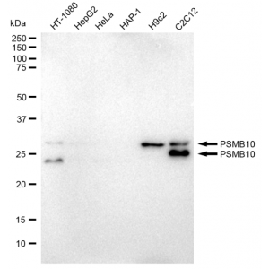 KD-Validated PSMB10 Rabbit mAb (20 μl)