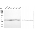 KD-Validated HPRT1 Rabbit mAb (20 μl)