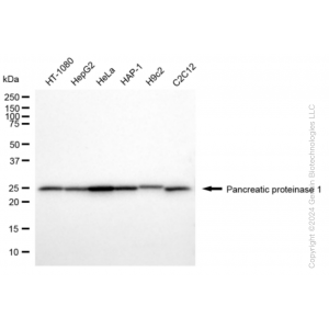 KD-Validated HPRT1 Rabbit mAb (20 μl)
