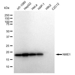 KD-Validated NME1 Rabbit mAb (20 μl)
