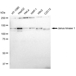 KD-Validated JAK1 Rabbit mAb (20 μl)
