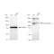 KD-Validated JAK1 Rabbit mAb (20 μl)