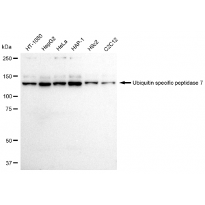 KD-Validated USP7 Rabbit mAb (20 μl)