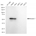KD-Validated K7 Rabbit mAb (20 μl)