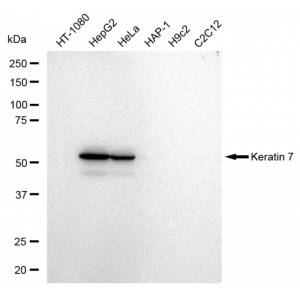 KD-Validated K7 Rabbit mAb (20 μl)