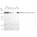 KD-Validated MRC1 (CD206) Rabbit mAb (20 μl)