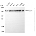 KD-Validated ROCK1 Rabbit mAb (20 μl)