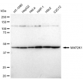 KD-Validated MAP2K1 Rabbit mAb (20 μl)