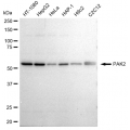 KD-Validated PAK2 Rabbit mAb (20 μl)