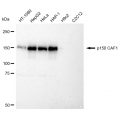 KD-Validated p150 CAF1 Rabbit mAb (20 μl)