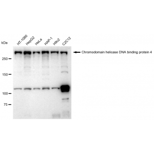 KD-Validated CHD-4 Rabbit mAb (20 μl)